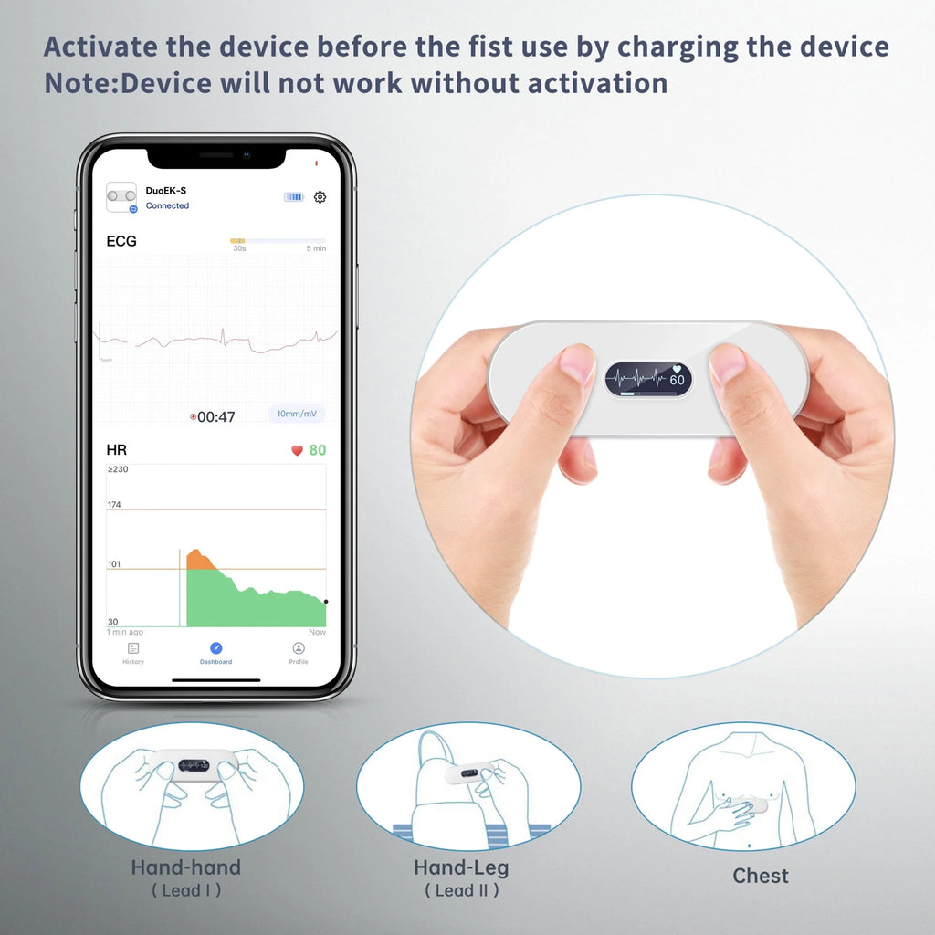 Handheld Bluetooth ECG Monitor with Screen Display S629