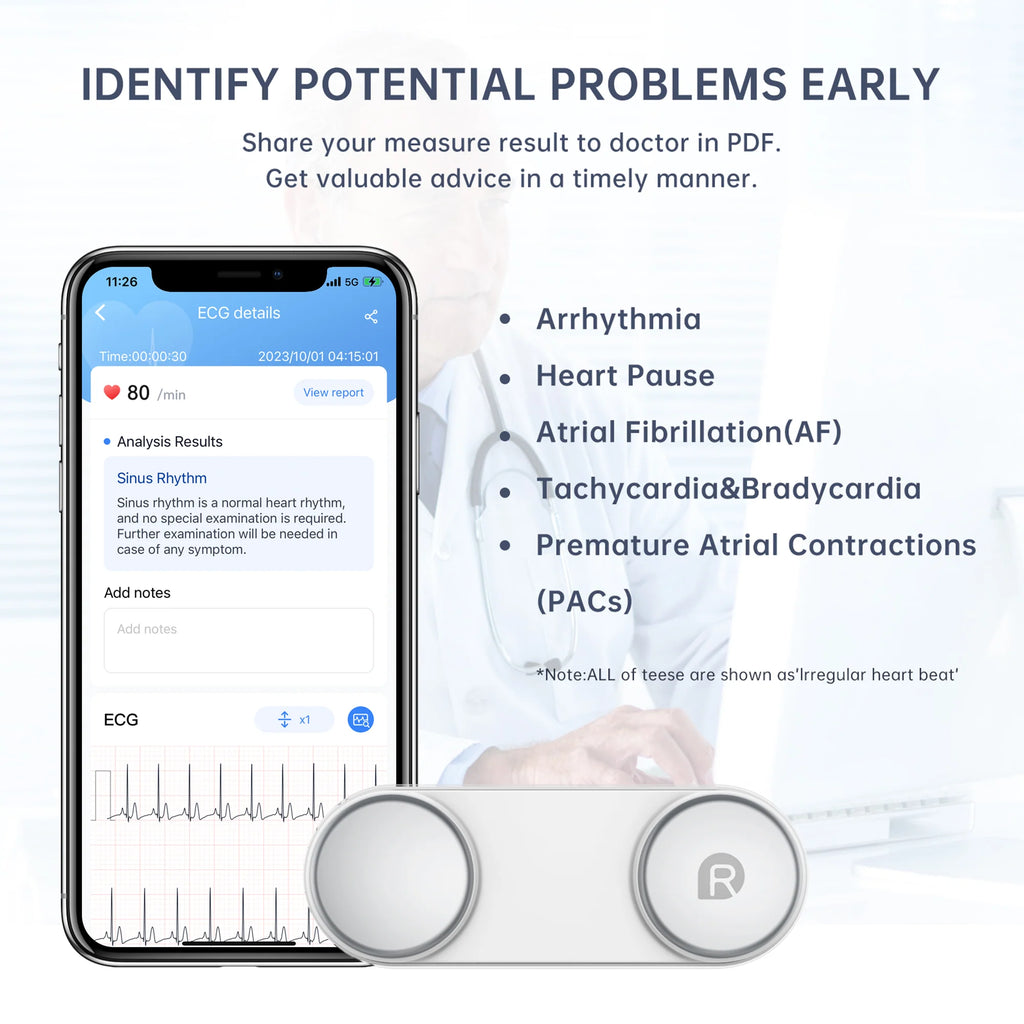 Handheld Bluetooth ECG Monitor with Screen Display S629